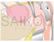CL（カラー線画）