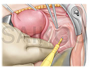 FB（フルブラシ）