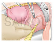 LB（線画ブラシ）