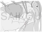 ML（モノクロ線画）